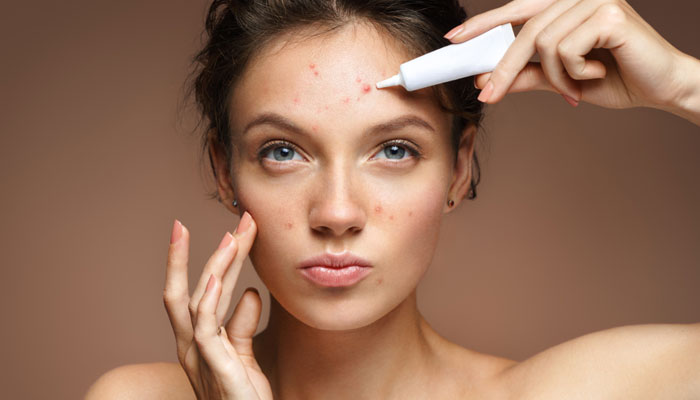 how-to-cure-acne
